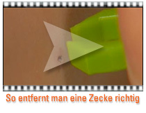 Video Zeckenentfernung